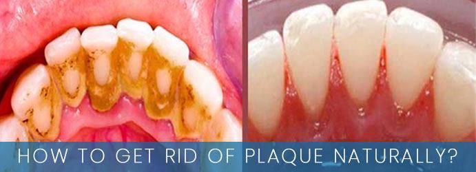 How to Get Rid of Plaque