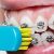 How Over Brushing Teeth Can Be a Problem?
