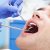 What Is The Best Alternative To Dental Implants