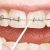 Considering Tips for Choosing a Dentist for Dental Treatment