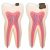 Things You Need To Know About The Root Canal Treatment
