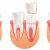 Tips To Prevent Cavities