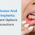 Gum Disease and Dental Implants: Understanding Treatment Options and Precautions