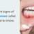 The silent signs of gum disease: what you need to know