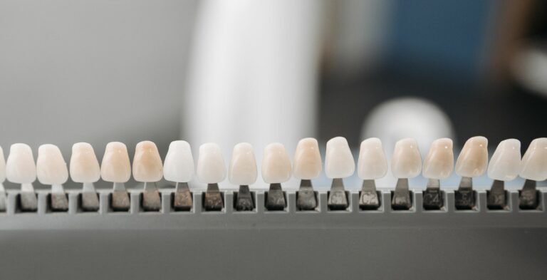 Veneers vs. Crowns