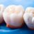 Sensitive Tooth After Filling: Causes, Treatment, and Relief